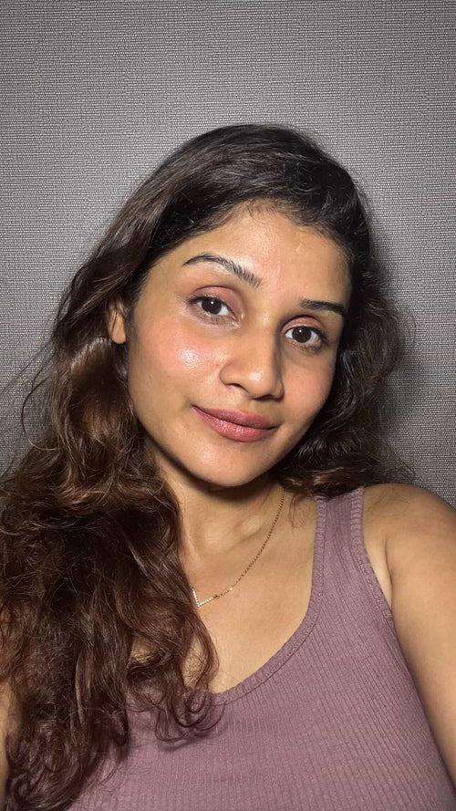 Skin condition before usage log